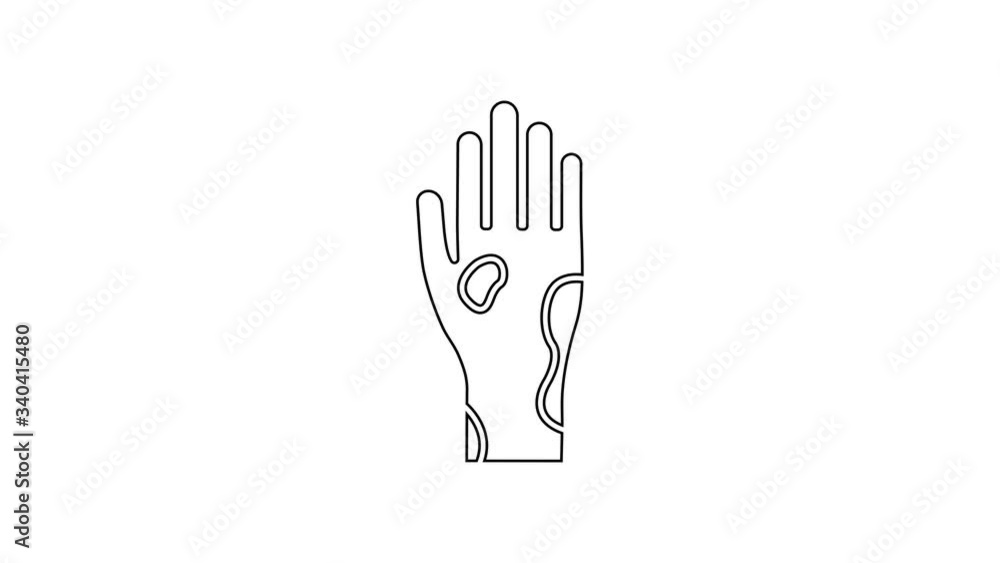 Black line Hand with psoriasis or eczema icon isolated on white background. Concept of human skin response to allergen or chronic body problem. 4K Video motion graphic animation Black line Hand with psoriasis or eczema icon isolated on white background. Concept of human skin response to allergen or chronic body problem. 4K Video motion graphic animation