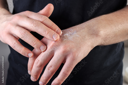 Close-up young caucasian man applying cream on his hand. Man is wearing a black t-shirt. Skin care concept.