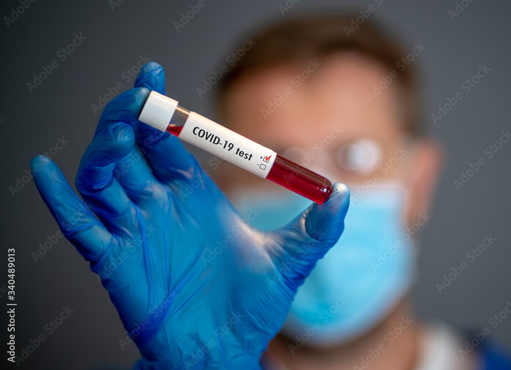 Scientist testing coronavirus positive blood sample researching for COVID-19 antibodies and vaccine