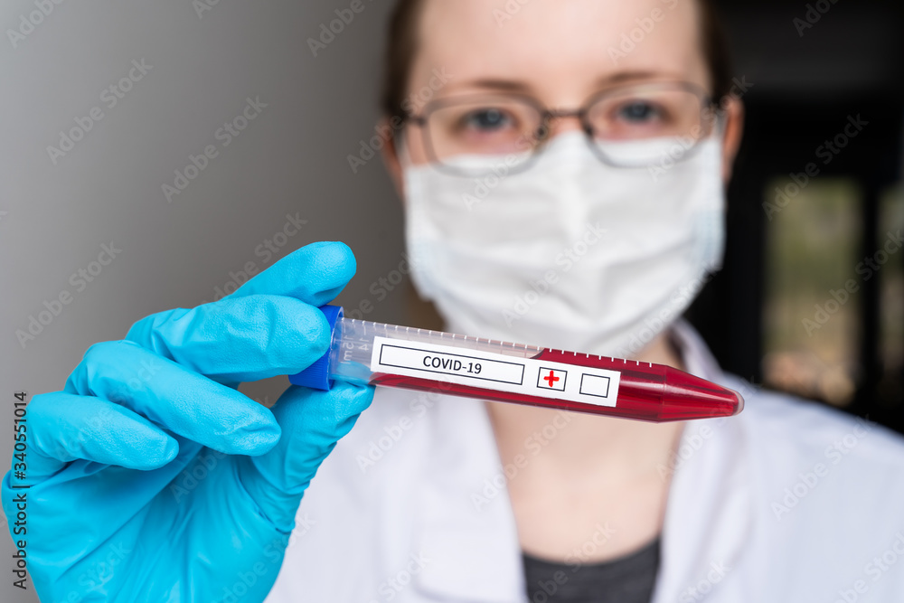A scientist holds a test tube with a blood test. A blood test for infection with a coronavirus or other infectious disease