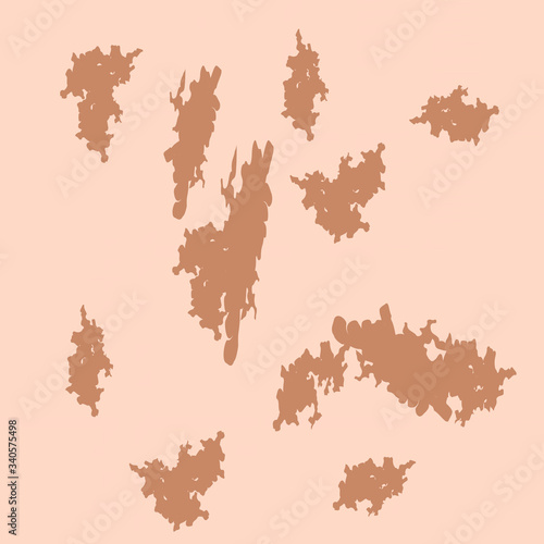 Pigmentation on the skin background. A pigmented spot on the skin of the face. Vector illustration