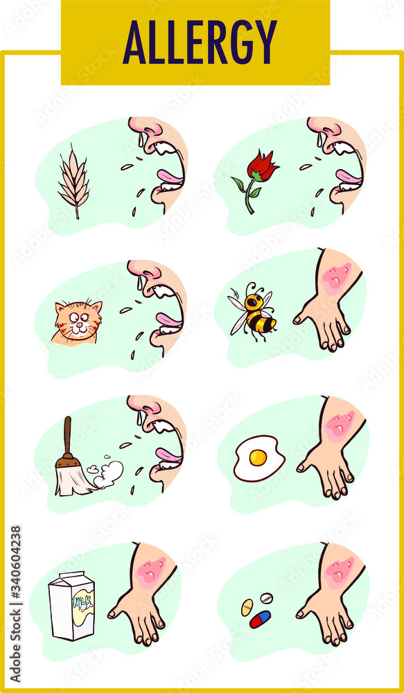 Allergy factor and man Vector illustration