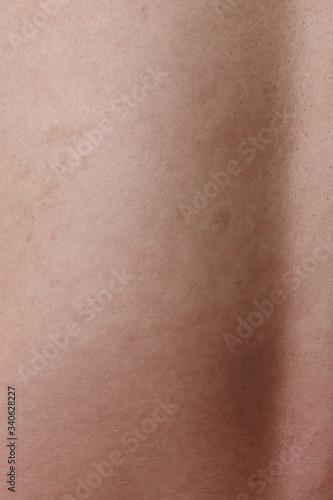 a close-up shot of the dull, rough surface of the skin.