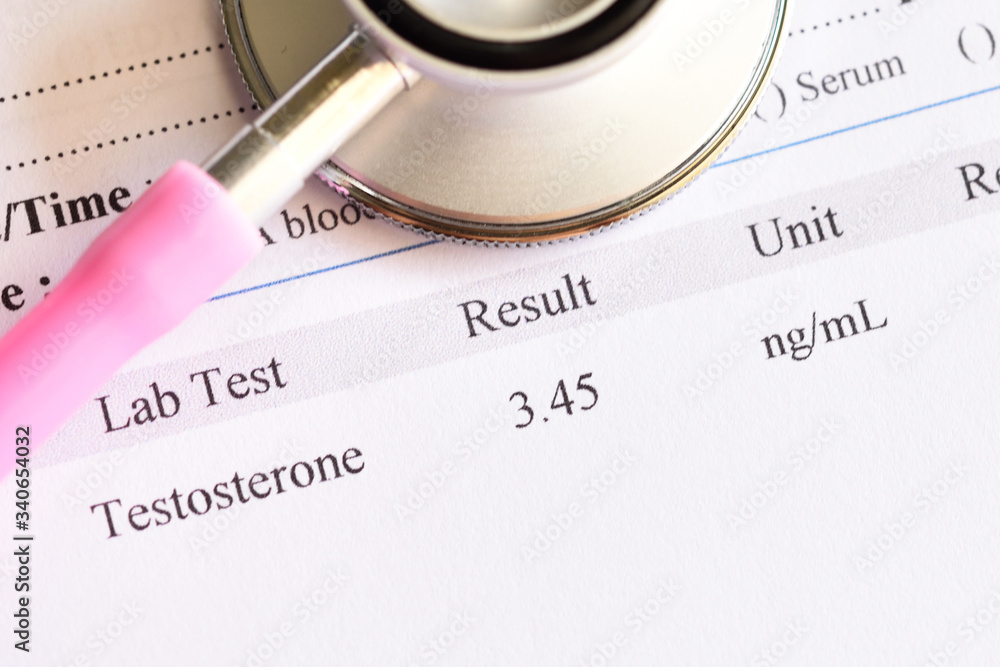 Obraz na plátně Normal testosterone hormone test result with stethoscope