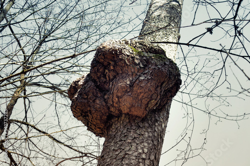 Huge excrescence on pine tree trunk. Sick diseased forest tree.
