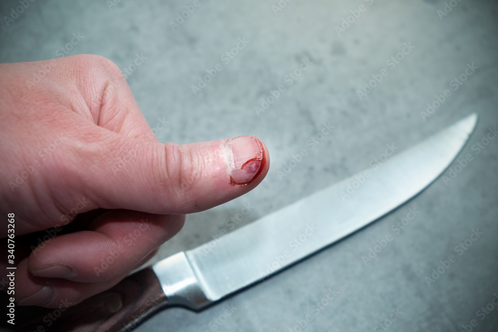 It's The Slow Knife That Cuts The Deepest Kitchen Knife Injury
