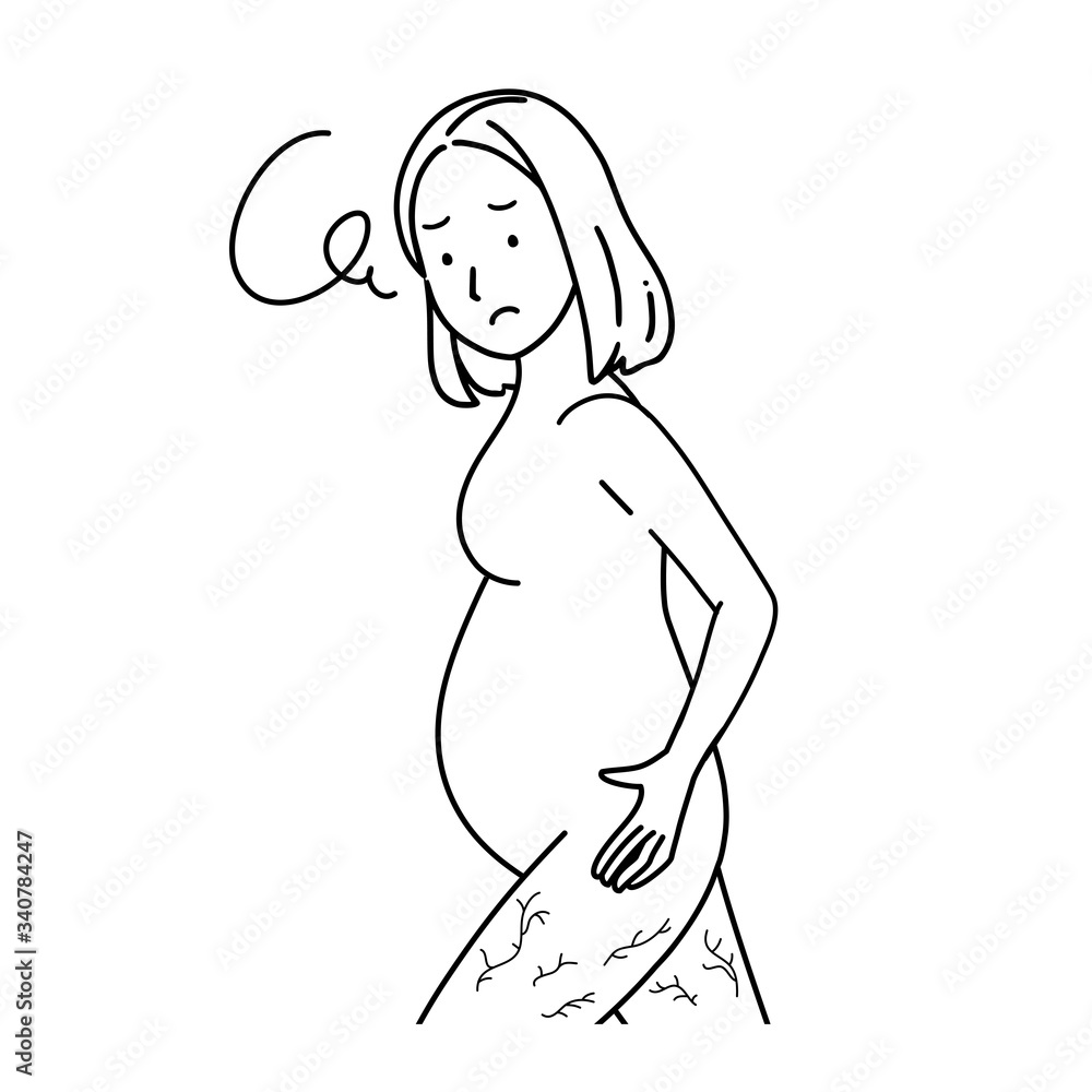 Illustration of a pregnant woman who is shocked by stretch marks.
Illustration of a pregnant woman who is shocked by stretch marks.