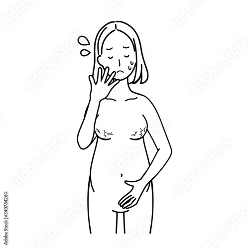 Illustration of a pregnant woman who is shocked by stretch marks.
