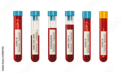 Laboratory blood test for virus Covid19. Set Realistic 3d glass test tube. Novel Coronavirus (2019-nCoV) denoted is single-stranded RNA virus. SARS-CoV2 Covid 19-NCP. vector illustration.