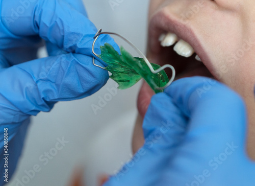 dentist's hands  in medical gloves put green children's orthodontic plaques on the child’s teeth, orthodontic bite correction, healthcare concept