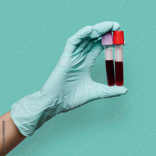 Hand holding a blood test tube mockups photo