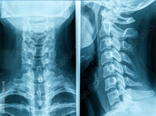 Detail of human neck X-ray image