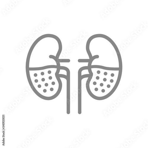 Chronic kidney disease line icon. Human organ for filtering blood, pyelonephritis, renal tuberculosis symbol