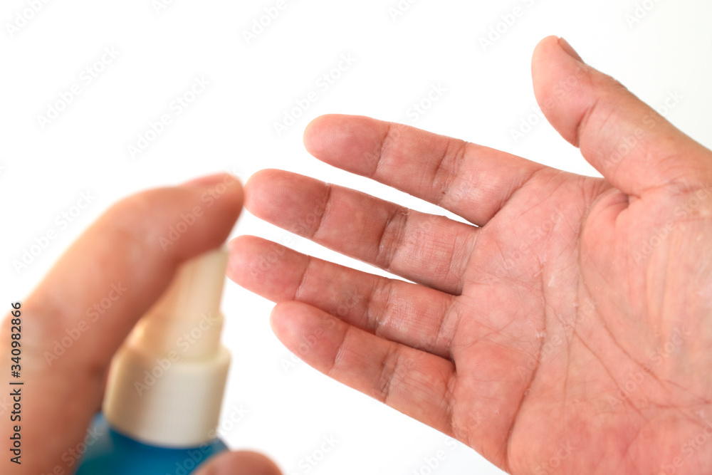 Inject alcohol on hand Inject alcohol on hand