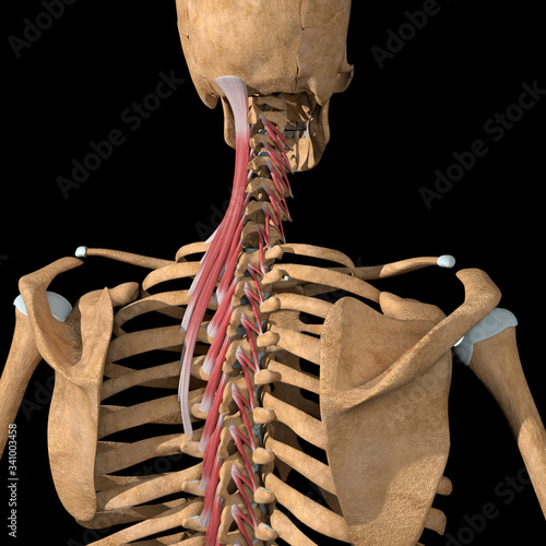 3d Illustration of the Transversospinalis Muscles Group Partial View