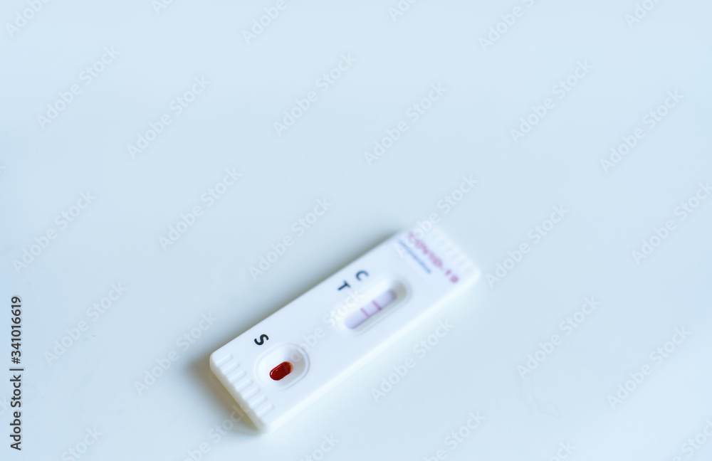 Testing for presence of coronavirus.Tests for COVID-19 with positive result. Testing for presence of coronavirus.Tests for COVID-19 with positive result.