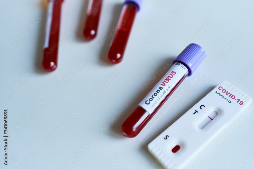 Test tube with blood sample for COVID-19 and rapid test for diagnosis Coronavirus infection. Test tube with blood sample for COVID-19 and rapid test for diagnosis Coronavirus infection.