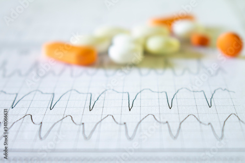 Obraz na płótnie Heartbeat represented on paper