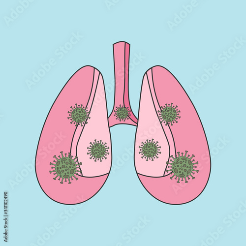 Flat vector illustration of lungs and bacteria cover-19 coronavirus. Coronavirus Pandemic. eps 10
