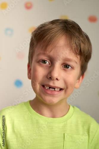 Kid showing missing teeth, he has lost two calfs teeth. Close up portrait of blonde caucasian boy smiling without two front teeth.