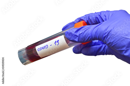 Coronavirus test, koronawirus