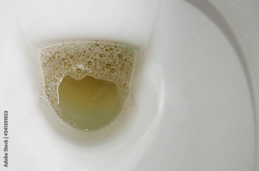 White ceramic toilet bowl full of urine, close-up shot Stock-Foto | Adobe  Stock