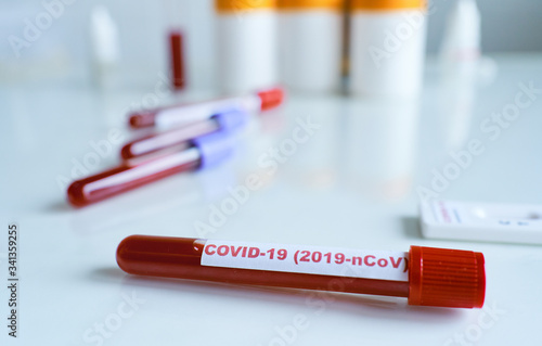 Test tubes containing a blood sample, blood test samples for presence of coronavirus.