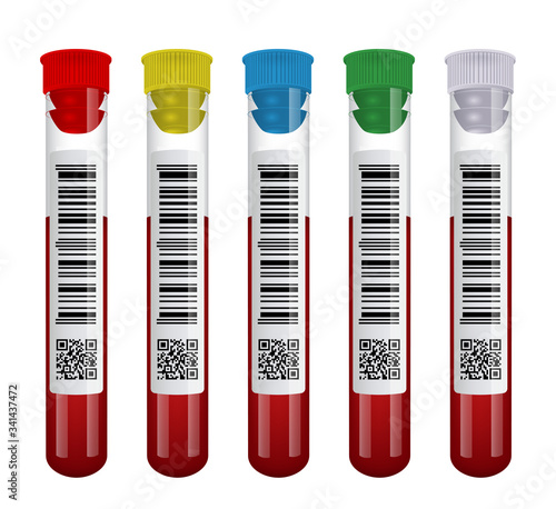 Medical blood test tube set isolated on white