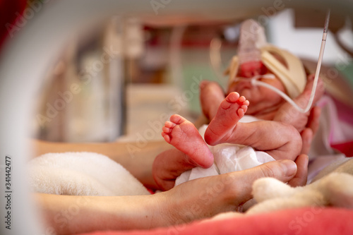 Premature newborn baby in incubator, ICU
