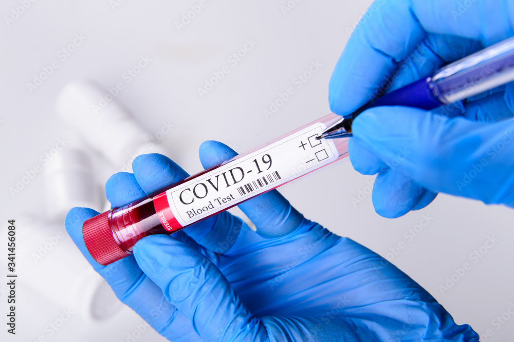 Covid-19 coronavirus disease blood test tube in hands epidemic concept background close-up Covid-19 coronavirus disease blood test tube in hands epidemic concept background close-up