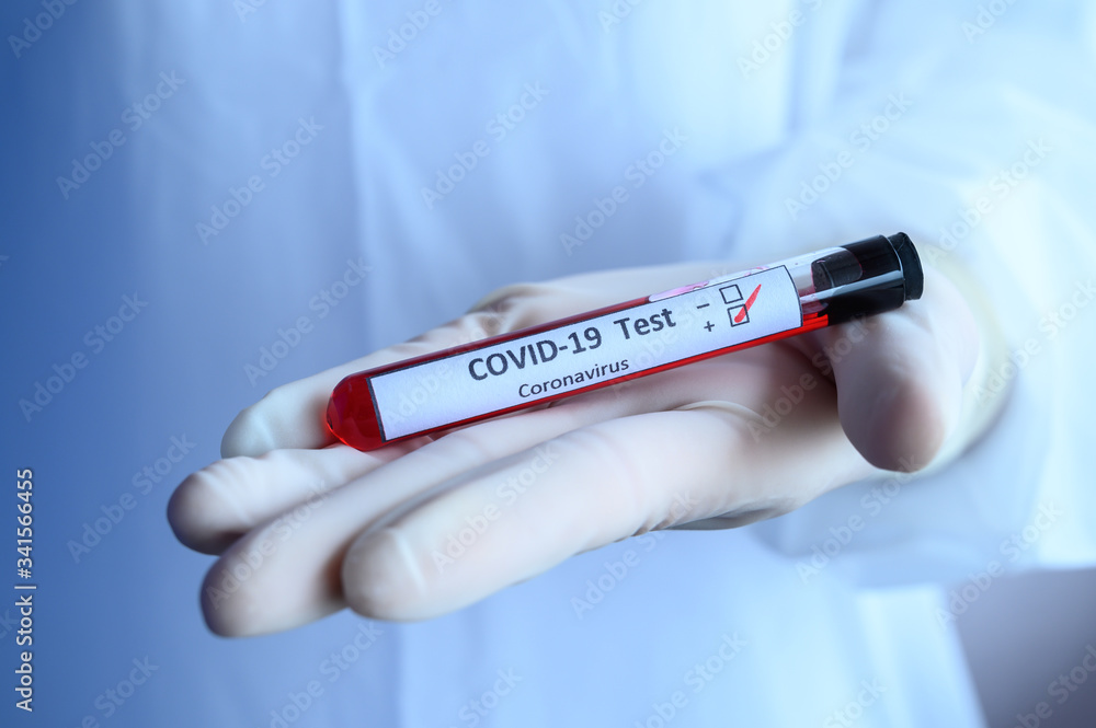 Obraz premium Close up of scientist doctor hand holding a sample test tube with blood for 2019-nCoV analyzing. Conceptual of laboratory testing for the respiratory coronavirus disease 2019 (COVID-19).