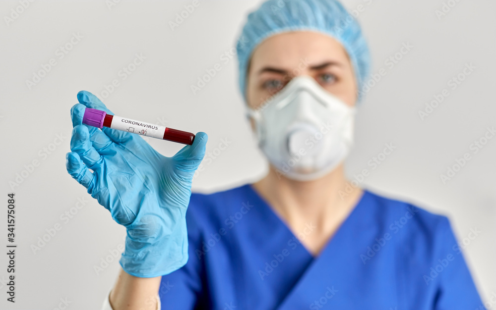 medicine, health and pandemic concept - close up of young female doctor or nurse holding beaker with coronavirus blood test medicine, health and pandemic concept - close up of young female doctor or nurse holding beaker with coronavirus blood test