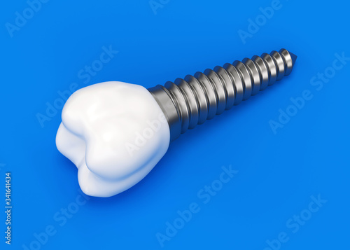 Fototapeta Naklejka Na Ścianę i Meble -  Dental prosthesis on blue background 3d rendering