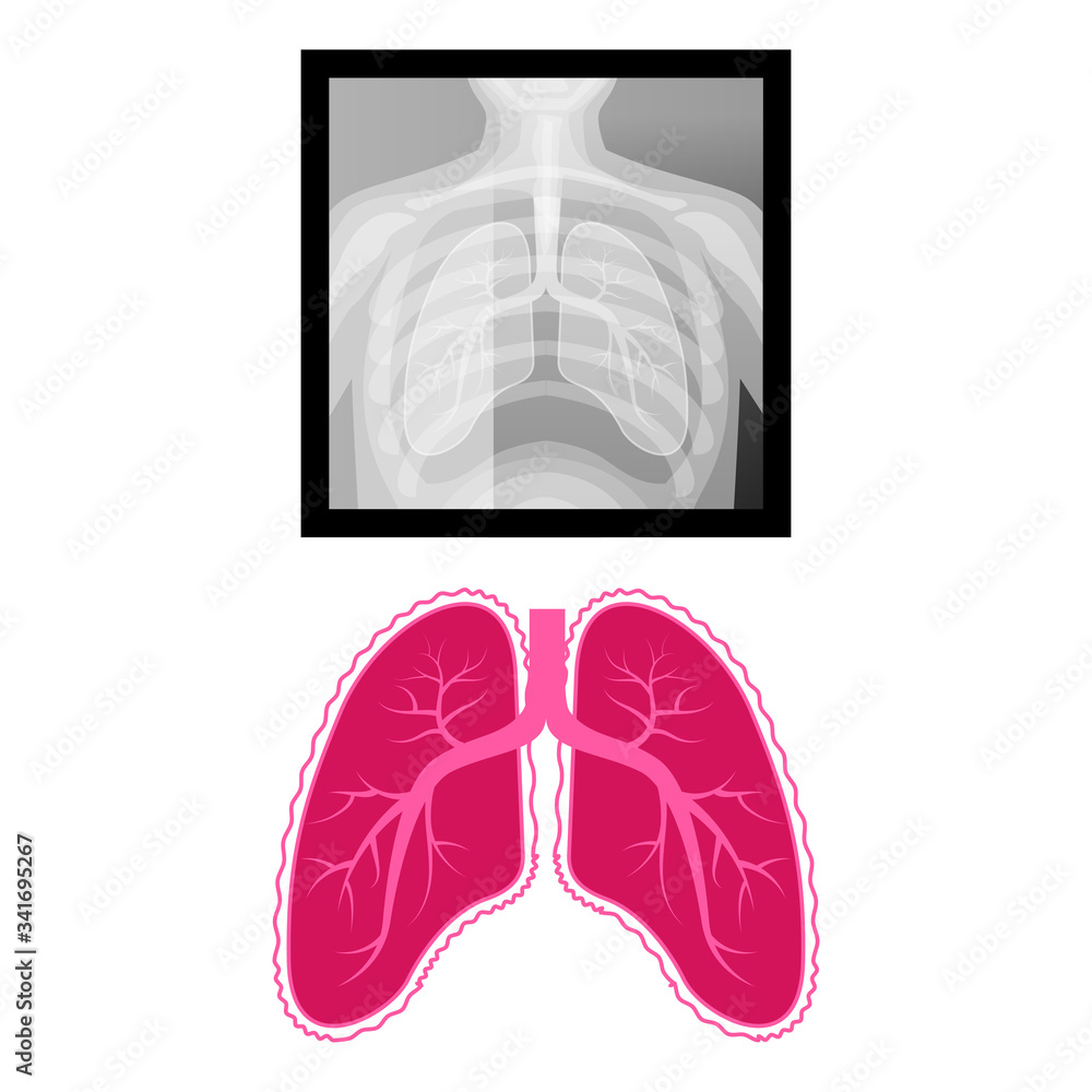 Vector illustration X-ray of the lungs, an example of the shape of the lungs