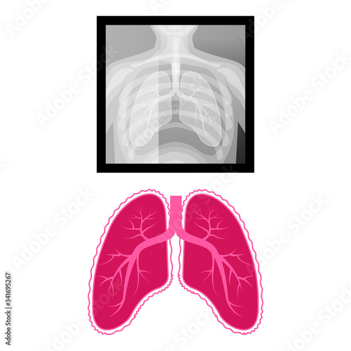 Vector illustration X-ray of the lungs, an example of the shape of the lungs