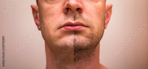 Closeup of man with beard on half of the face on grey background. Portrait of a handsome man with a shaved half his face.