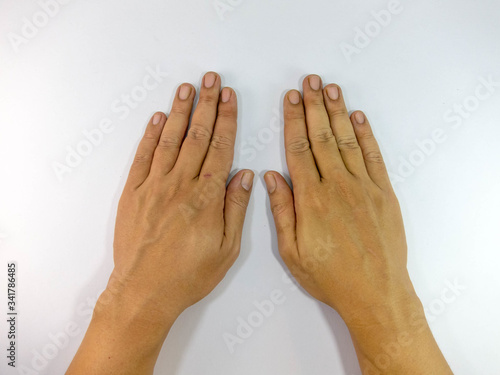 The hands of men in various gestures.