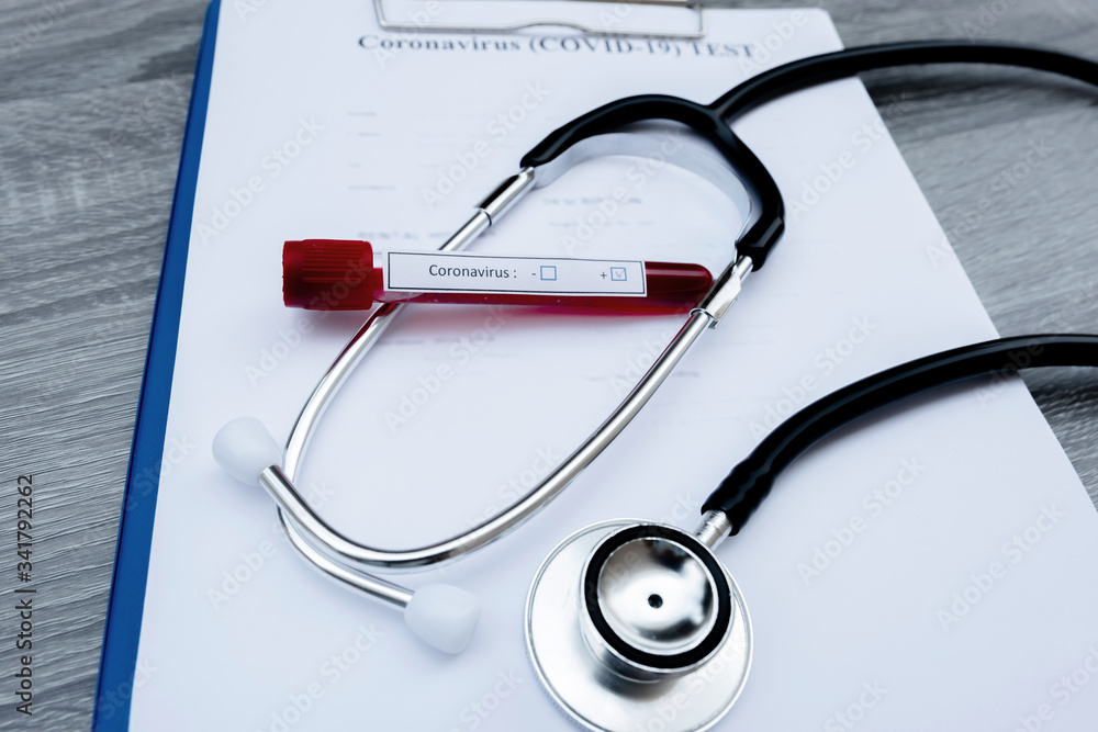 The picture of blood tube of coronavirus test and stethoscope in white background The picture of blood tube of coronavirus test and stethoscope in white background