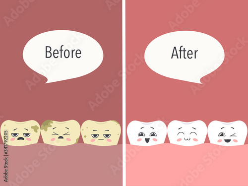 Before and after - the concept of dental care. Dirty miserable teeth and funny kawaii teeth. Vector illustration