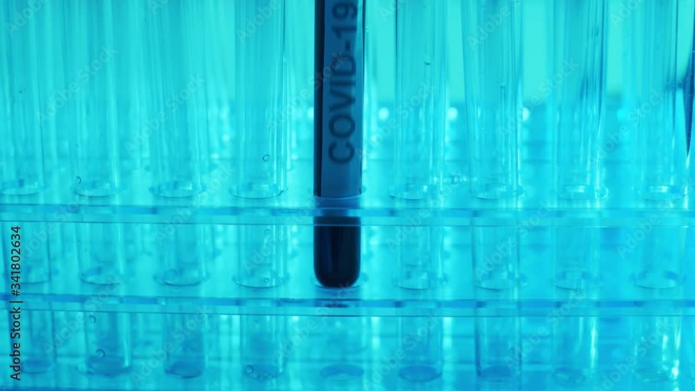 Laboratory tube with blood and virus. Scientific lab closeup. Pandemic