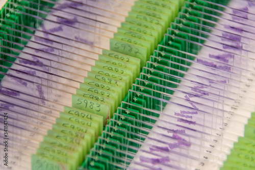 Φωτογραφία Series of histology specimen slides