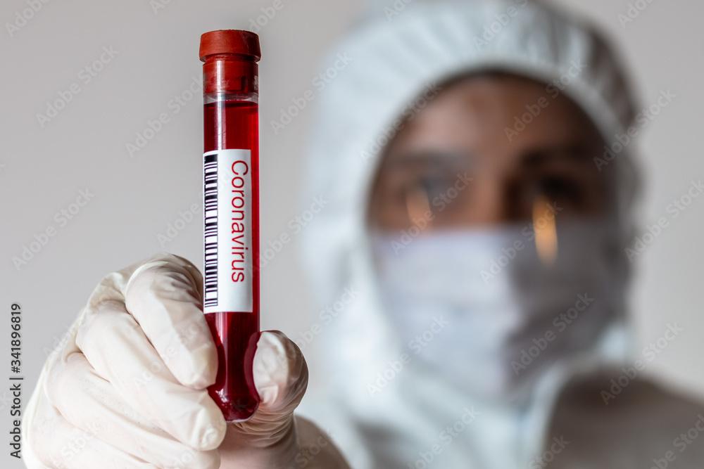 Doctor or nurse holding a positively marked blood test tube for covid-19 coronavirus disease Doctor or nurse holding a positively marked blood test tube for covid-19 coronavirus disease