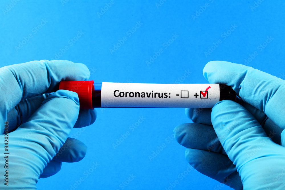 Obraz premium Coronavirus. Doctor's hand in a blue glove. Blood sample in vitro for analysis. Blue background.