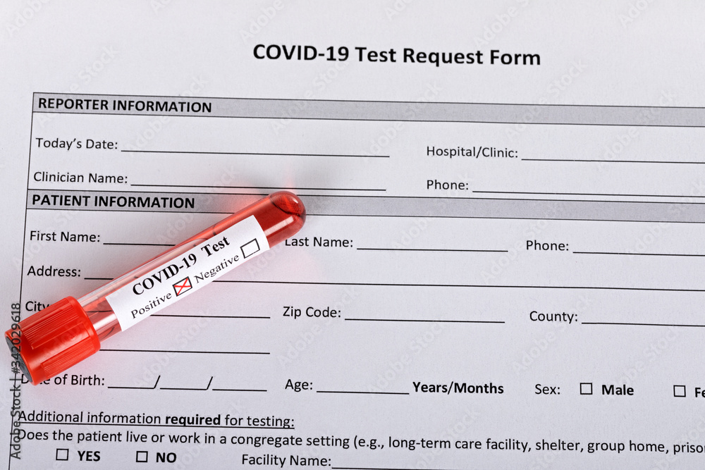 Obraz premium Covid-19 blood test
