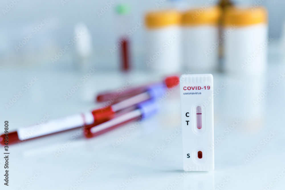 Tests for COVID-19 with negative result, lab card kit test for viral influenza.