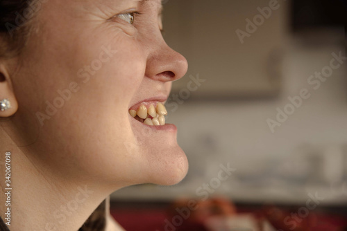 фотографія Crooked teeth