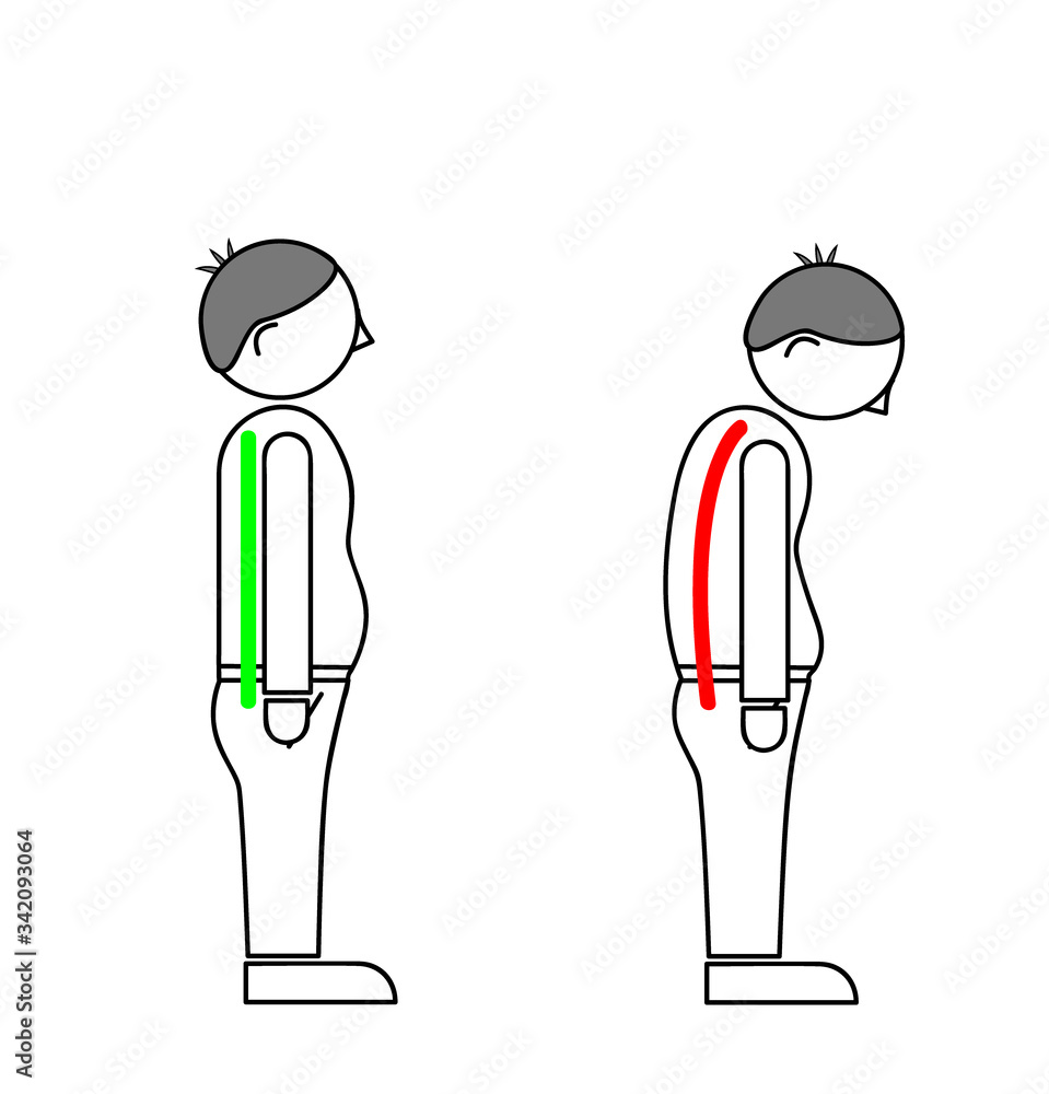 Correct alignment of human body in standing posture for good personality and healthy of spine and bone. Health care and medical illustration Correct alignment of human body in standing posture for good personality and healthy of spine and bone. Health care and medical illustration