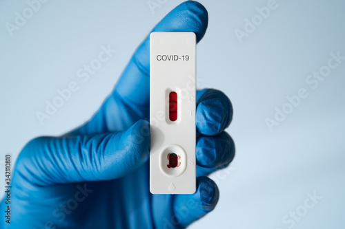 Doctor holding a test kit for viral disease COVID-19 2019-nCoV. Lab card kit test for coronavirus SARS-CoV-2 virus. Fast test COVID-19. Possitive COVID-19. photo