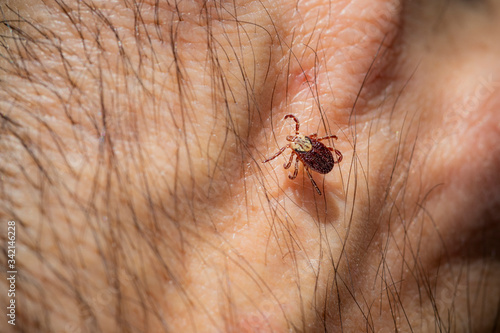 Mite tick. A tipical summer parasite in Europe. May cause several dangerouse infections and illness like erlechiosis, encephalitis, potomac fever and others photo