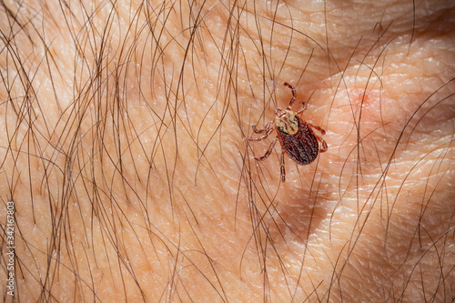 Mite tick. A tipical summer parasite in Europe. May cause several dangerouse infections and illness like erlechiosis, encephalitis, potomac fever and others